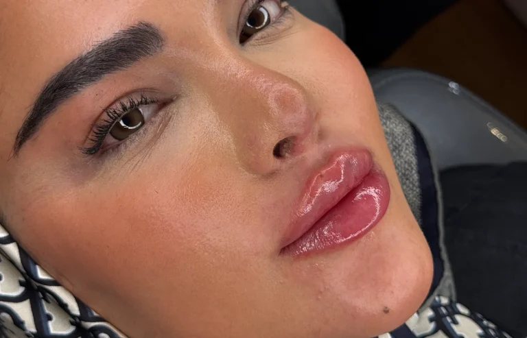 Lip_gel2