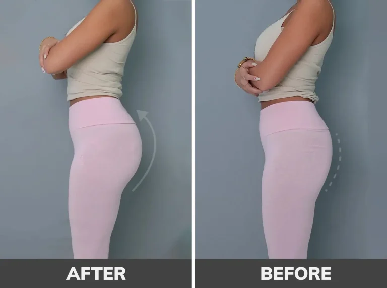 body-filler-1