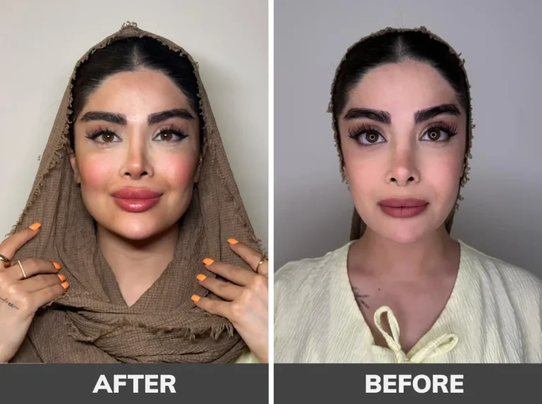 gel-contouring-1