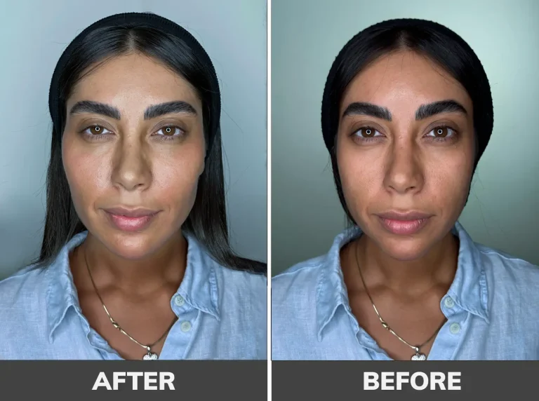 gel-contouring-4