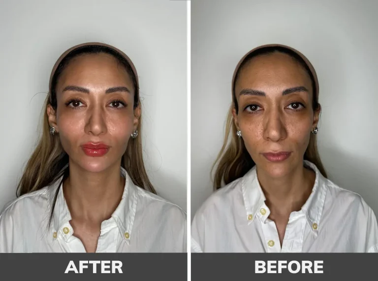 gel-contouring-8